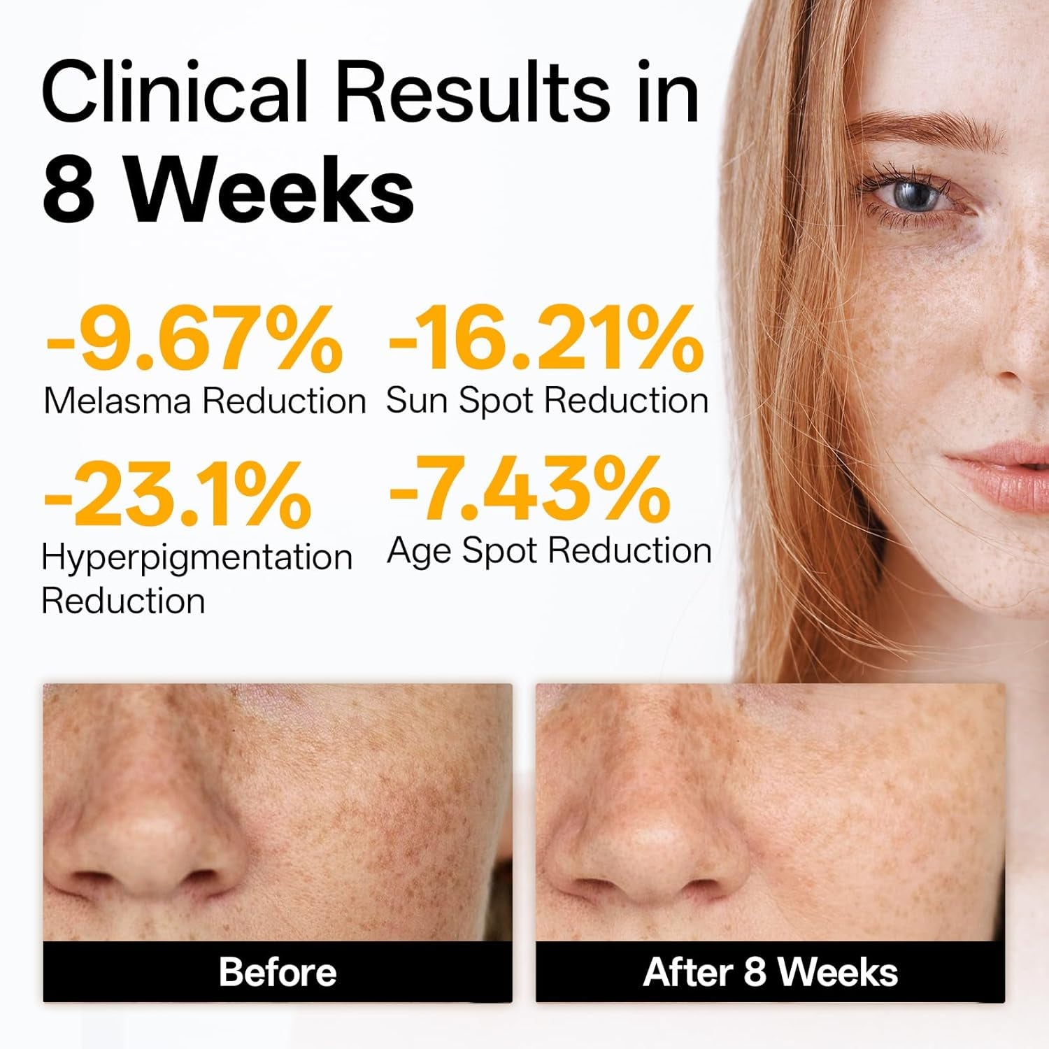 Vitamin C Brightening Facial Serum